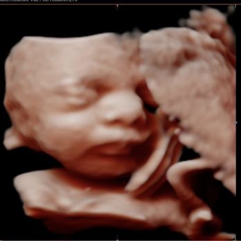 Forever Yours Ultrasound - Ultrasound Imaging Centers Near Me - Fullerton, California