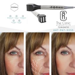 The Clinic at Beverly Hills - Forma Skin Tightening
