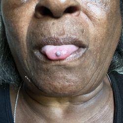 Dental Implant Center of Sumter - I can't eat it hurts can you please help me