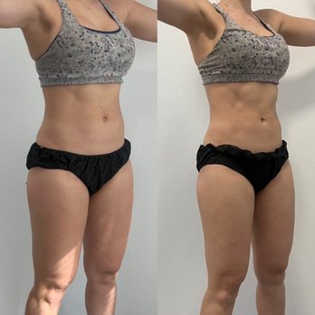 Weight Loss Shots - Weight Loss Centers Near Me Weight Loss Shots - Weight Loss Centers Near Me