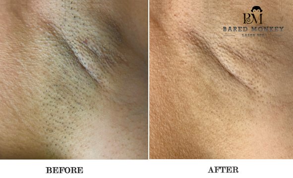 Bared Monkey Laser Spa by null