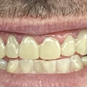Pure Dental - General Dentistry Near Me - Woodbridge, Virginia Pure Dental - General Dentistry Near Me - Woodbridge, Virginia