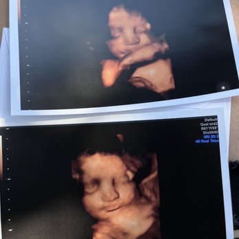 The Baby Connection - Baby Xirena Elizabeth @ 31 weeks! - Diagnostic Imaging Near Me - Sacramento, California The Baby Connection - Baby Xirena Elizabeth @ 31 weeks! - Diagnostic Imaging Near Me - Sacramento, California