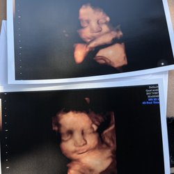 The Baby Connection - Baby Xirena Elizabeth @ 31 weeks!