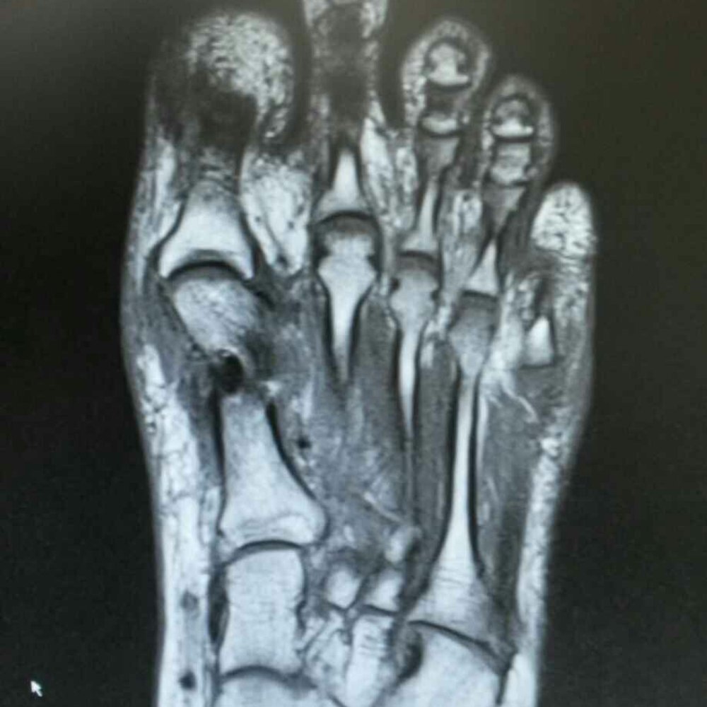 Utmb Health - See mri damage from fist surgery - Ophthalmologists Near Me - Galveston, Texas Utmb Health - See mri damage from fist surgery - Ophthalmologists Near Me - Galveston, Texas