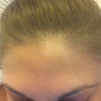 Amazing Lash Studio - As you can see the outer side is gone completely - Eyelash Service Near Me - Coral Gables, Florida Amazing Lash Studio - As you can see the outer side is gone completely - Eyelash Service Near Me - Coral Gables, Florida