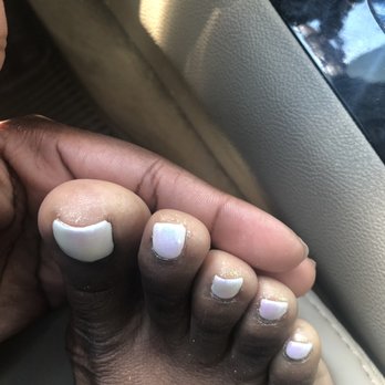 Sunshine Nails - Didn't bother to clean my toes and Left glitter and polish all around them. Messy! - Nail Salons Near Me - Alexandria, Virginia Sunshine Nails - Didn't bother to clean my toes and Left glitter and polish all around them. Messy! - Nail Salons Near Me - Alexandria, Virginia