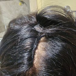 Extension placement