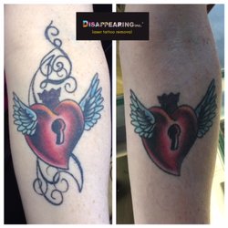 Sometimes you just don't want a piece of your tattoo.