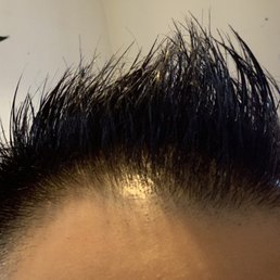 Who buzzes the front like this? Ever think of what it'll look like in a week when there's little grass growing on your forehead? Who buzzes the front like this? Ever think of what it'll look like in a week when there's little grass growing on your forehead?
