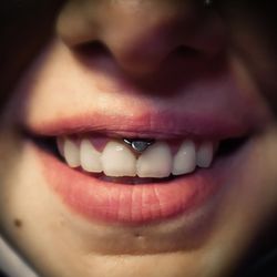 MBA - My Body Art - Piercing smiley, réalisé à MBA - My Body Art
