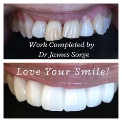 Oak Hollow Family Dentistry - Love your Smile!