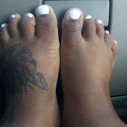 Perfect experience toes finally looking good. Perfect experience toes finally looking good.