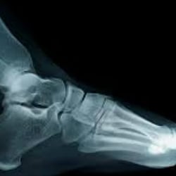 Battle Ground Foot and Ankle