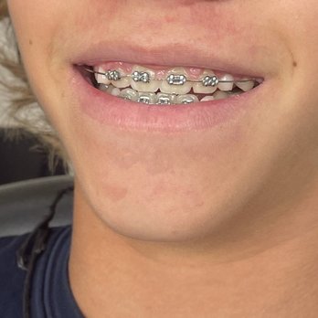 Blackburn & Williams Orthodontics - Braces!! - Orthodontists Near Me - Katy, Texas