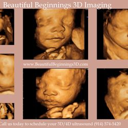 Beautiful Beginnings 3D Imaging - Our images are the best quality! You receive 40-100 images on a CD and 8-12 photo prints along with DVD recording & much more !