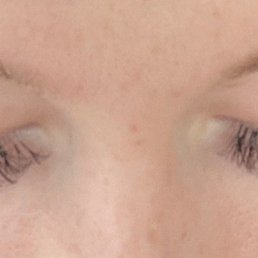 after the "fill" after the "fill"
