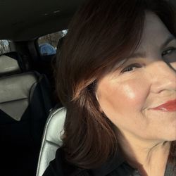 Lasting Impression - Deep wrinkles have deminshed and plummeted skin is present