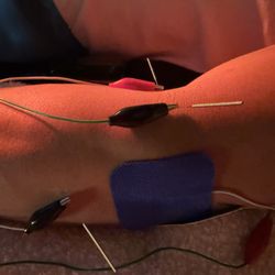 Lanie Quan, DAOM, LAC -Equilibrate Acupuncture