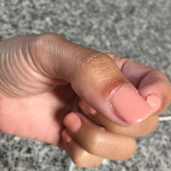 ProTop Nails - Skin filed away - Nail Salons Near Me - Roseville, California ProTop Nails - Skin filed away - Nail Salons Near Me - Roseville, California