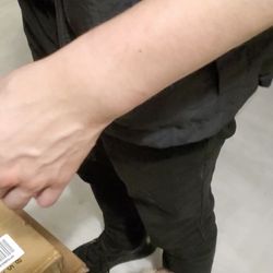 Doral Police Department - Swollen wrists from being handcuffed 20 hours