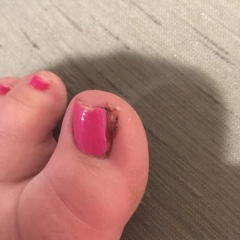 Envy Nails Spa - Hang nail - Nail Salons Near Me - Bridgeville, Pennsylvania