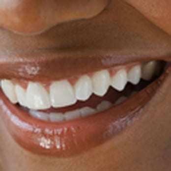 Ellet Dental - General Dentistry Near Me - Akron, Ohio Ellet Dental - General Dentistry Near Me - Akron, Ohio