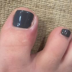 Natural Nails - My infected toe