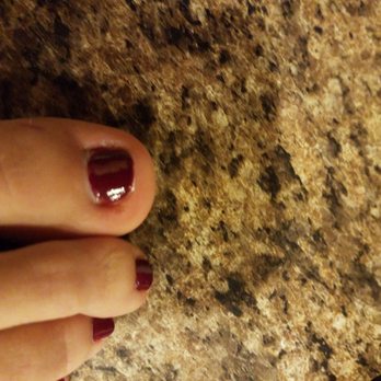 Dream Nails - This is my right toe. Huge difference. Wouldn't u agree - Nail Salons Near Me - Kennesaw, Georgia