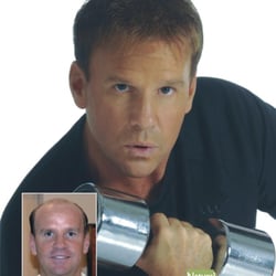 Thinning Hair Solutions - Hair Restoration without limitations!