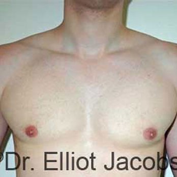 Elliot W. Jacobs, MD - Cosmetic Surgeons Near Me - Boca Raton, Florida Elliot W. Jacobs, MD - Cosmetic Surgeons Near Me - Boca Raton, Florida