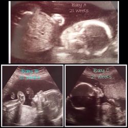Perinatal Diagnostic Center & Women's Ultrasound