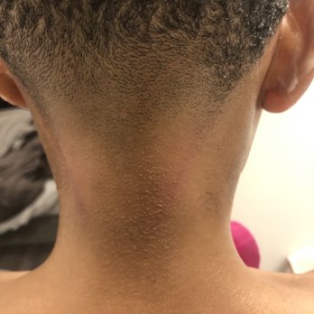 Unique Looks LLC - Why is his neck so scraped up in order to remove hair? - Barbers Near Me - Glen Burnie, Maryland Unique Looks LLC - Why is his neck so scraped up in order to remove hair? - Barbers Near Me - Glen Burnie, Maryland