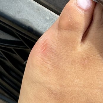 Royal Nails - Cut from the callus remover - Nail Salons Near Me - Brownsville, Texas Royal Nails - Cut from the callus remover - Nail Salons Near Me - Brownsville, Texas