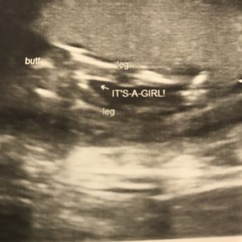 Baby Bump Studios - Diagnostic Imaging Near Me - Ontario, California Baby Bump Studios - Diagnostic Imaging Near Me - Ontario, California