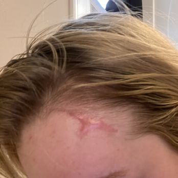 Valley Plastic Surgery & Medi-Spa - Botched! I never agreed to scars here - Medical Spas Near Me - Hunt Valley, Maryland Valley Plastic Surgery & Medi-Spa - Botched! I never agreed to scars here - Medical Spas Near Me - Hunt Valley, Maryland