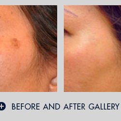 Waxed & Skin - Remove brown spots
