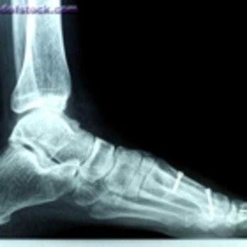 Clinique Podiatrique - Photo - Podiatrists Near Me - LaSalle, Quebec Clinique Podiatrique - Photo - Podiatrists Near Me - LaSalle, Quebec