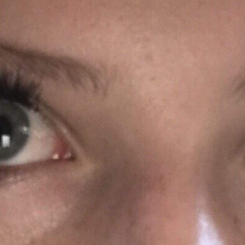 The day after my appointment for eyelash extensions at Karisma. A large chunk has already fallen out on one of my eyes. The day after my appointment for eyelash extensions at Karisma. A large chunk has already fallen out on one of my eyes.
