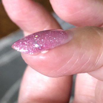 Sassy Nail - Painful white bump surfaced where there was no prior hangnail. - Nail Salons Near Me - Santa Clara, California Sassy Nail - Painful white bump surfaced where there was no prior hangnail. - Nail Salons Near Me - Santa Clara, California