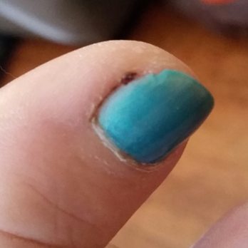 Nail Today - She cut the side of my big toe. It still hurts 4 days later. Even the corner of the nail is jagged. - Nail Salons Near Me - Oakland, California Nail Today - She cut the side of my big toe. It still hurts 4 days later. Even the corner of the nail is jagged. - Nail Salons Near Me - Oakland, California