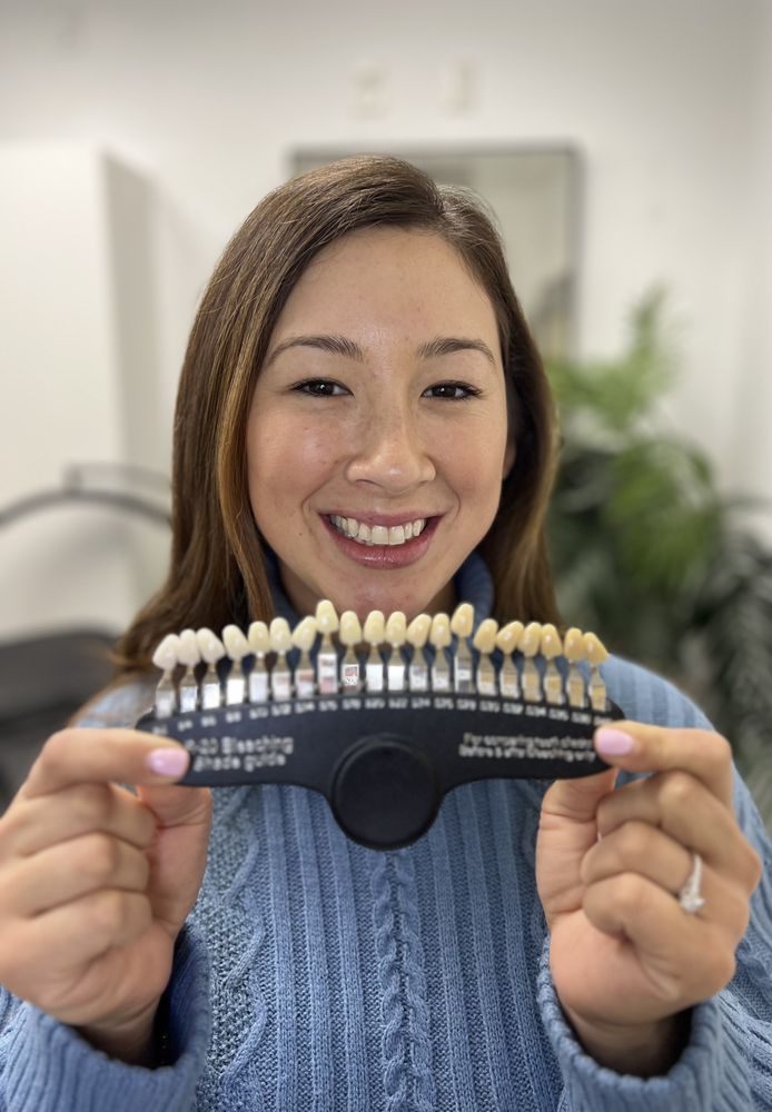 THE COCO BLANC TEETH WHITENING Updated August 2024 26 Photos & 31