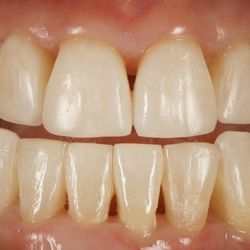 ORIS Dental Studio - After - photo top and bottom