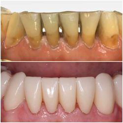 Novi Reconstructive Dentistry