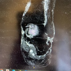 Capital Foot & Ankle Surgeons of Austin - Ankle Pain