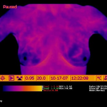 Nicholas LeRoy, DC, MS - Radiation-free breast cancer screening. - Chiropractors Near Me - Chicago, Illinois