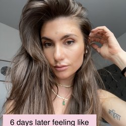 Bend Aesthetics and Wellness - Love my pout!