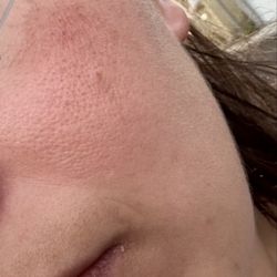Sahar's Beauty Touch - This is before going to Sahar. My skin had darker pigmentation.