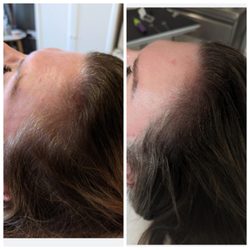 Crown Design - Before/After add density to temples!