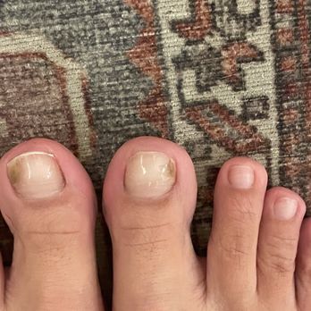 American Nails - Fungus!!!! - Nail Salons Near Me - Grand Terrace, California
